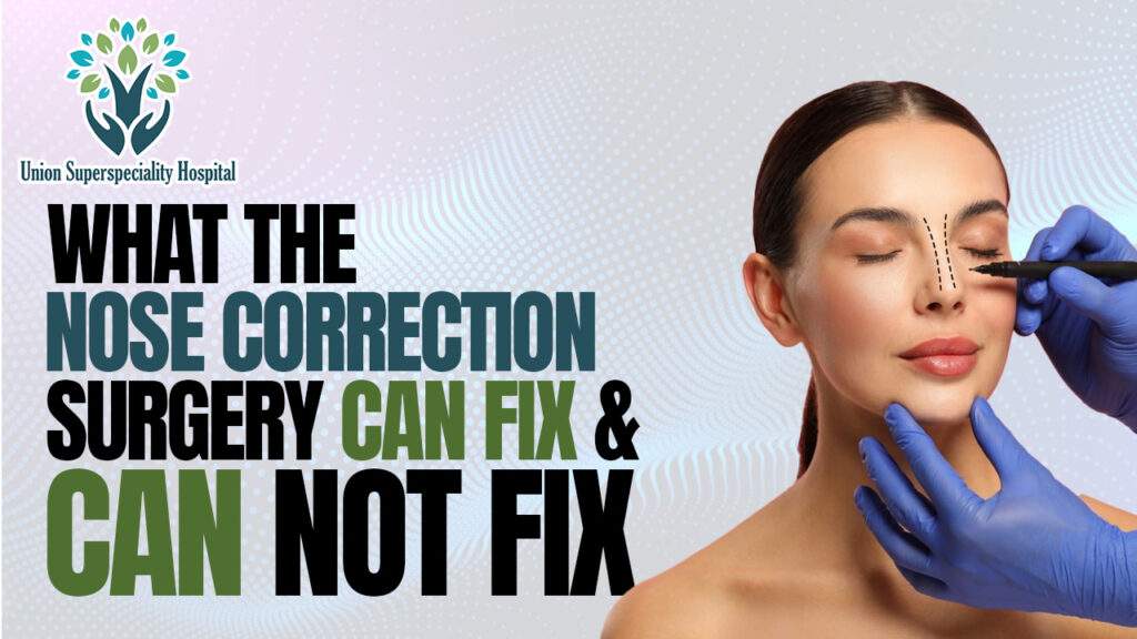 What The nose correction surgery can fix and can not fix
